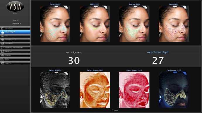 Visualisation d'indications mises en évidence par Visia Complexion Analysis : points noirs, rides et ridules, dilatation des pores