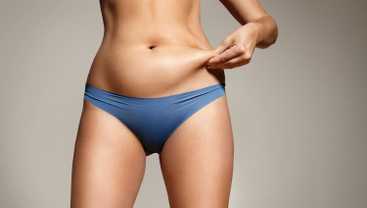 Liposuction: Fat removal surgery
