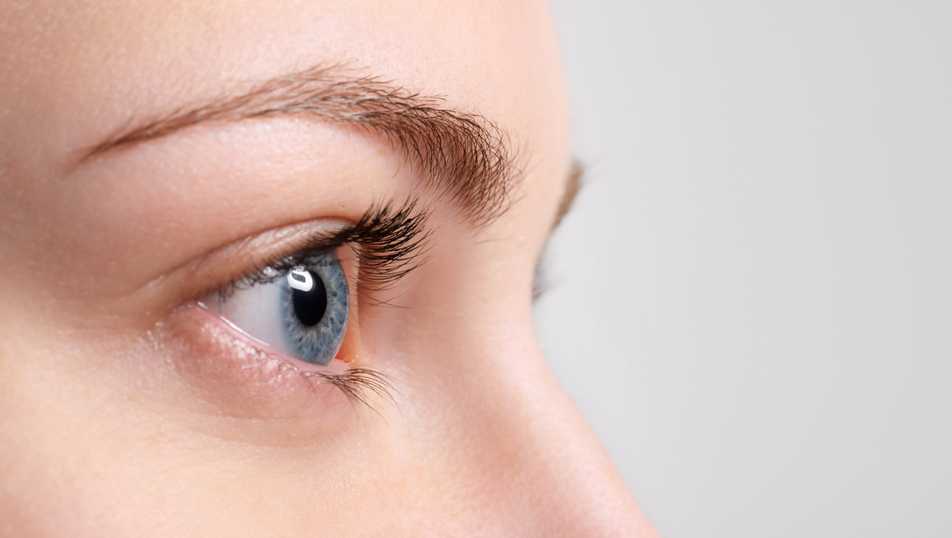 Botox injections for crow's feet
