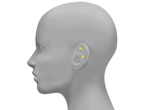 Using the preFold positioning system to predict the result of the intervention