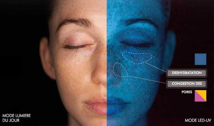 Diagnostic visage realisé avec le dispositif Skinscope de SkinCeuticals