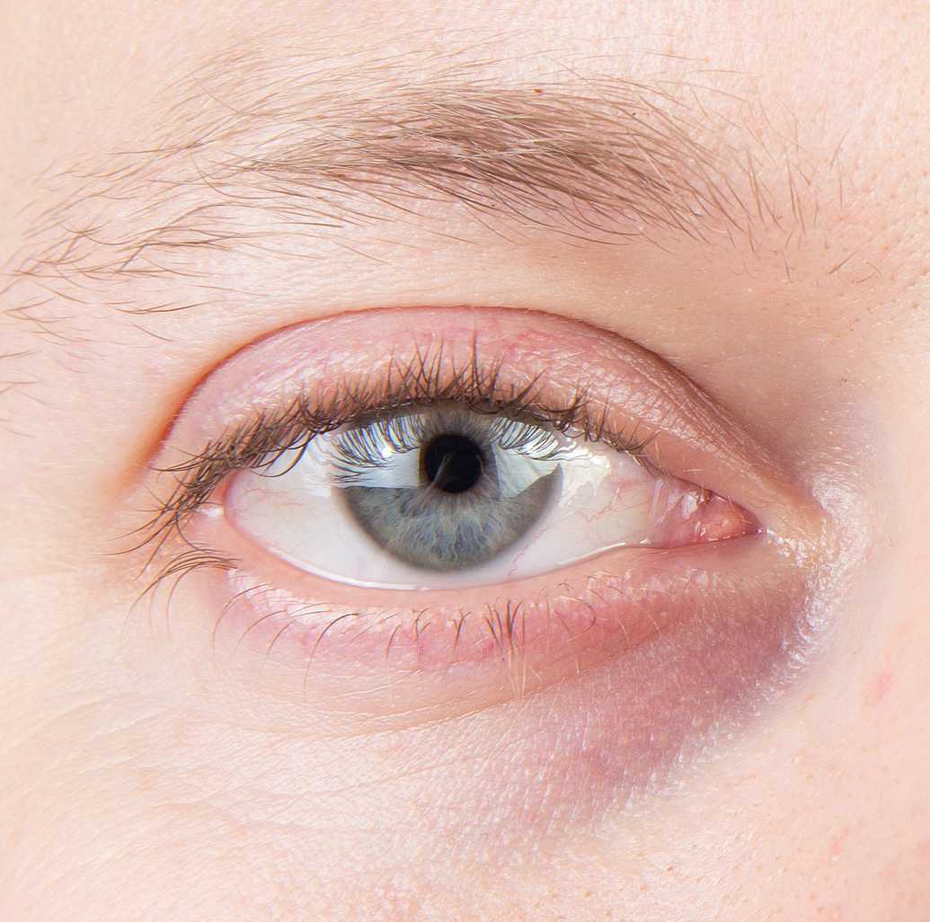 Quels sont les différents types de cernes ? Comment prévenir leur apparition