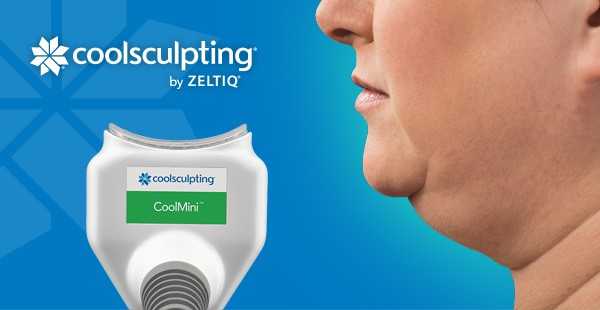 CoolMini Coolsculpting, une alternative à la lipoaspiration du cou