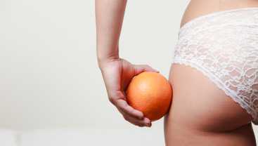 Keybody-cellulite : Traitement médical définitif de la cellulite