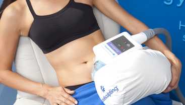 Cryolipolyse with Coolsculpting