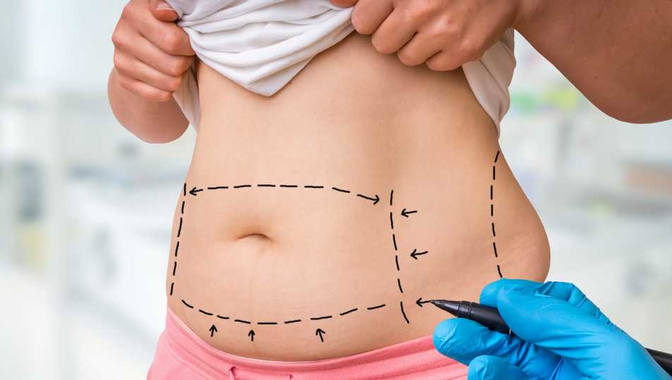 Gaine Post Opératoire Abdominoplastie ou Liposuccion Abdominale