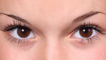 Blepharoplasty: Eyelid surgery