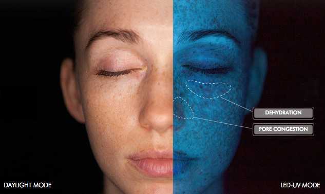 Diagnostic de votre peau avec le Skinscope LED
