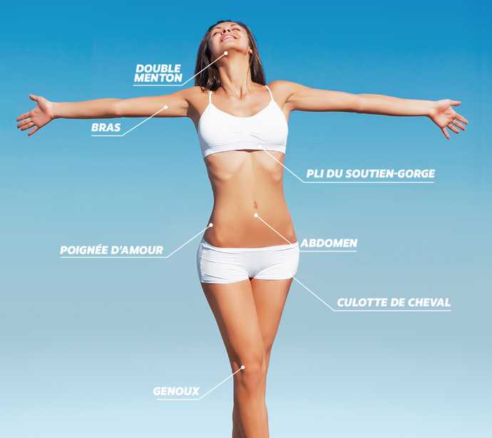 Zones traitées par la cryolipolyse avec Coolsculting