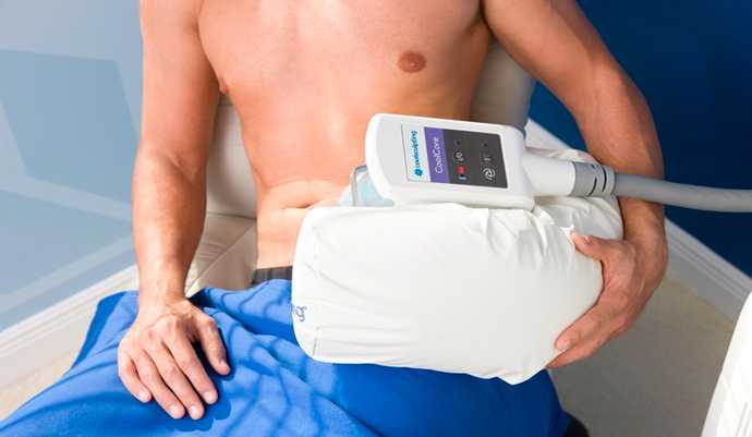 Treatment of belly fat by cryolipolysis with Coolsculpting