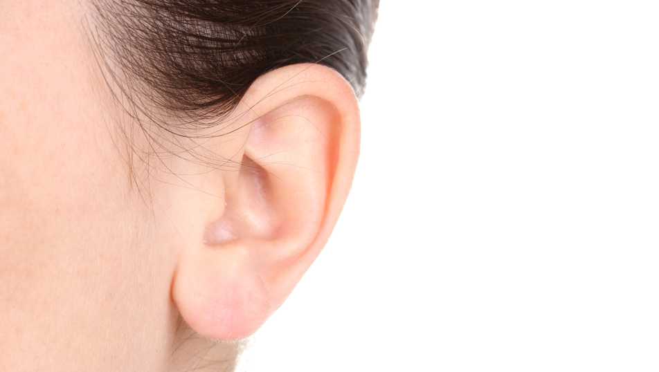 Otoplasty : Prominent ear surgical correction